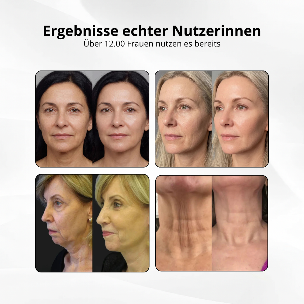 V-Sculpt™ – Dein 5-Minuten Face Lift für zuhause