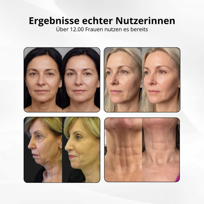 V-Sculpt™ – Dein 5-Minuten Face Lift für zuhause