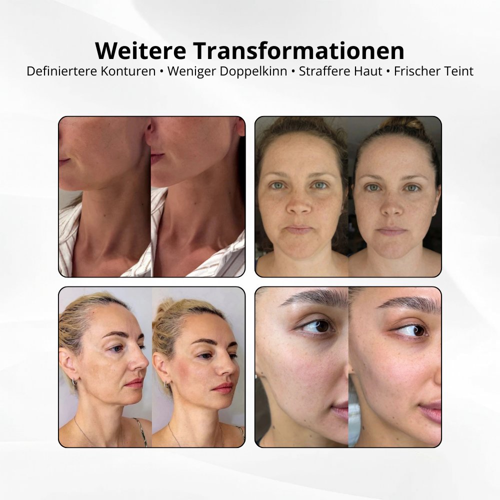 V-Sculpt™ – Dein 5-Minuten Face Lift für zuhause