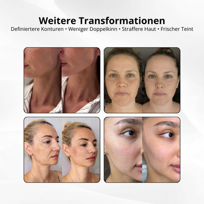 V-Sculpt™ – Dein 5-Minuten Face Lift für zuhause